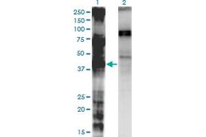 Western Blot analysis of LASS3 expression in transfected 293T cell line by LASS3 monoclonal antibody (M02), clone 6C12. (LASS3 Antikörper  (AA 57-134))