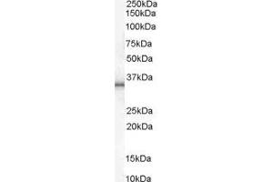 Western Blotting (WB) image for Uncoupling Protein 1 (Mitochondrial, Proton Carrier) (UCP1) peptide (ABIN369048) (Uncoupling Protein 1 (Mitochondrial, Proton Carrier) (UCP1) Peptid)