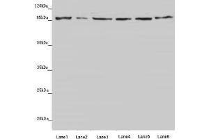 Western blot All lanes: YME1L1 antibody at 3. (YME1L1 Antikörper  (AA 1-240))