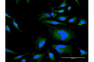 Immunofluorescence of purified MaxPab antibody to RGS21 on HeLa cell. (RGS21 Antikörper  (AA 1-152))