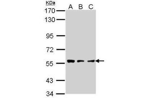 WB Image Sample (30 ug of whole cell lysate) A: A431 , B: H1299 C: Hela 7. (TPP1 Antikörper)
