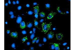 Anti-AK4 mouse monoclonal antibody (ABIN2454798) immunofluorescent staining of COS7 cells transiently transfected by pCMV6-ENTRY AK4 (RC220572). (AK4 Antikörper)