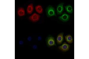 ABIN6259103 and ABIN6275220 staining Hela cells by IF/ICC. (MBL2 Antikörper  (N-Term))