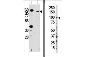 (LEFT) Western blot analysis of anti-hFGFR2-R22 Pab in 293 cell line lysates transiently transfected with the FGFR2 gene (2ug/lane). (FGFR2 Antikörper  (N-Term))