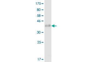 Western Blot detection against Immunogen (35. (TNFRSF11A Antikörper  (AA 69-152))