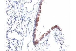 Immunohistochemistry (IHC) image for anti-Mesothelin (MSLN) (AA 273-407) antibody (ABIN6939032)