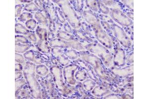 IHC analysis of CFP using anti-CFP antibody (ABIN6719298). (CFP Antikörper)