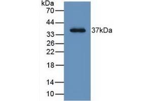 Detection of Recombinant LRG1, Human using Monoclonal Antibody to Leucine Rich Alpha-2-Glycoprotein 1 (LRG1) (LRG1 Antikörper  (AA 37-340))
