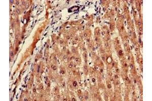 Immunohistochemistry of paraffin-embedded human liver tissue using ABIN7152606 at dilution of 1:100 (FADS1 Antikörper  (AA 1-121))