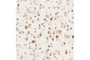 Immunohistochemistry of paraffin embedded mouse brain using CHST6 (ABIN7073302) at dilution of 1:2000 (300x lens) (CHST6 Antikörper)