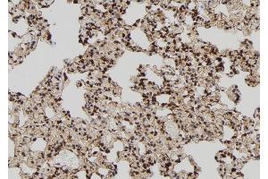 ABIN6273020 at 1/100 staining Rat lung tissue by IHC-P. (TIA1 Antikörper  (Internal Region))