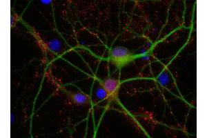 Indirect immunostaining of PFA fixed rat hippocampus neurons with anti-synaptogyrin 1 (dilution 1 : 500; red) and mouse anti-MAP 2 (, dilution 1 : 500; green). (Synaptogyrin 1 Antikörper  (AA 220-234))