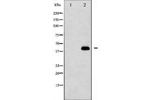 Western blot analysis of MEK1 phosphorylation expression in K562 whole cell lysates,The lane on the left is treated with the antigen-specific peptide. (MEK1 Antikörper  (pThr292))