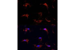 Immunofluorescence analysis of C6 cells using FBN1 Polyclonal Antibody (ABIN7267176) at dilution of 1:100 (40x lens). (Fibrillin 1 Antikörper  (AA 360-460))