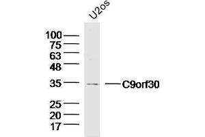 Lane 1: U2-OS lysates probed with C9orf30 Polyclonal Antibody, Unconjugated  at 1:300 overnight at 4˚C.