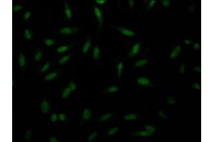 Immunofluorescence staining of Hela Cells with ABIN7127663 at 1:50, counter-stained with DAPI. (Rekombinanter PAK1 Antikörper)