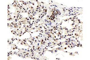 Immunohistochemistry analysis of paraffin-embedded Rat lung using LEP Polyclonal Antibody at dilution of 1:100. (Leptin Antikörper)