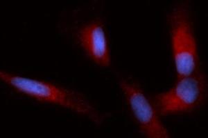 Immunofluorescence (IF) image for anti-Immunoglobulin Binding Protein (BIP) (AA 20-650) antibody (PE) (ABIN5566443) (BIP Antikörper  (AA 20-650) (PE))