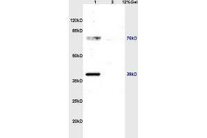 Lane 1: rat brain lysates Lane 2: rat kidney lysates probed with Anti ZNF185 Polyclonal Antibody, Unconjugated (ABIN762716) at 1:200 in 4 °C. (Zinc Finger Protein 185 Antikörper  (AA 551-650))