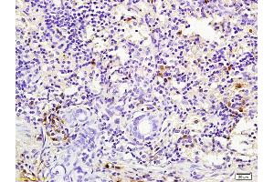Formalin-fixed and paraffin embedded mouse lung labeled with Rabbit Anti pro-caspase-3 Polyclonal Antibody, Unconjugated (ABIN747728) at 1:200 followed by conjugation to the secondary antibody and DAB staining (Caspase 3 Antikörper  (AA 11-120))