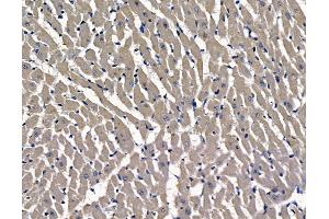 ABIN7096970 and ABIN7101037 at 1/100 staining rat heart tissue by IHC-P.
