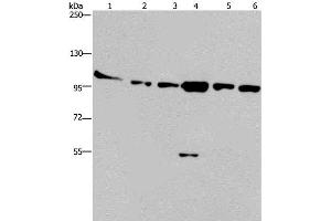 Western Blot analysis of Human testis tissue, K562, A549, Raji, NIH/3T3 and Hela cell using PRKD3 Polyclonal Antibody at dilution of 1:200 (PRKD3 Antikörper)