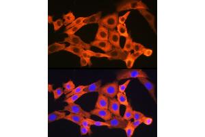 Immunofluorescence analysis of NIH-3T3 cells using JNK1/JNK3 Rabbit mAb (ABIN1678909, ABIN7101754, ABIN7101755 and ABIN7101756) at dilution of 1:100 (40x lens). (JNK Antikörper)