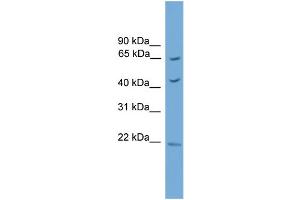 WB Suggested Anti-Tbx18 Antibody Titration:  0. (T-Box 18 Antikörper  (Middle Region))