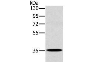 Western Blot analysis of A172 cell using CLP36 Polyclonal Antibody at dilution of 1:400 (PDLIM1 Antikörper)