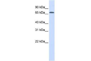 WB Suggested Anti-IRF2BP1 Antibody Titration: 0. (IRF2BP1 Antikörper  (Middle Region))