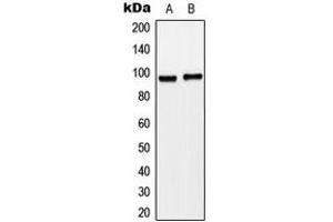 Western blot analysis of Matriptase expression in HeLa (A), SW620 (B) whole cell lysates. (ST14 Antikörper  (N-Term))