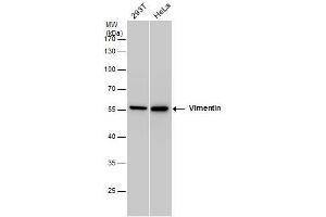 WB Image Vimentin antibody detects Vimentin protein by western blot analysis. (Vimentin Antikörper)