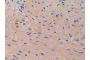 Immunohistochemistry (IHC) image for anti-Cadherin-16 (CDH16) (AA 353-617) antibody (ABIN7441937)