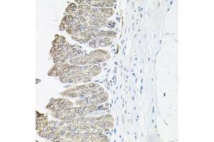 Immunohistochemistry of paraffin-embedded mouse stomach using B1 antibody (ABIN6127389, ABIN6137306, ABIN6137309 and ABIN6221475) at dilution of 1:100 (40x lens). (ATP1B1 Antikörper  (AA 63-303))