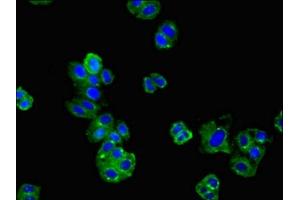 Immunofluorescence (IF) image for anti-Angiotensin II Receptor, Type 1 (AGTR1) (AA 306-356) antibody (ABIN7173980)