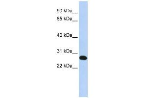 WB Suggested Anti-FAM119A Antibody Titration: 0. (FAM119A Antikörper  (N-Term))