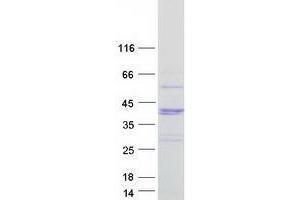 Validation with Western Blot (WBP2NL Protein (Myc-DYKDDDDK Tag))