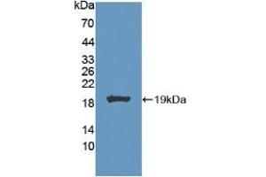 Western blot analysis of recombinant Mouse CA7. (CA7 Antikörper  (AA 58-217))