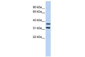 ZNF254 antibody used at 1. (ZNF254 Antikörper  (Middle Region))