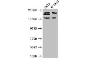 Western Blot Positive WB detected in: Hela whole cell lysate, HEK293 whole cell lysate All lanes: ITSN2 antibody at 4 μg/mL Secondary Goat polyclonal to rabbit IgG at 1/50000 dilution Predicted band size: 194, 191, 142, 136 kDa Observed band size: 194, 191, 142 kDa (Intersectin 2 Antikörper  (AA 940-1209))