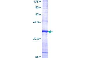 Chemokine (C Motif) Ligand 1 (XCL1) (AA 22-114) protein (GST tag)