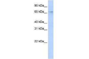 WB Suggested Anti-A1CF Antibody Titration:  0. (A1CF Antikörper  (N-Term))