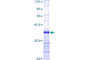 Image no. 1 for phospholipase C, gamma 1 (PLCG1) (AA 1192-1291) protein (GST tag) (ABIN1315336) (Phospholipase C gamma 1 Protein (AA 1192-1291) (GST tag))