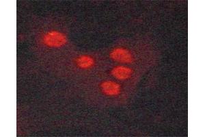 Immunofluorescence (fixed cells) (IF/ICC) image for anti-DNA-Damage-Inducible Transcript 3 (DDIT3) (pSer30) antibody (ABIN6256253)