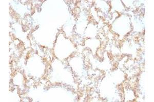 Immunohistochemistry (Formalin-fixed Paraffin-embedded Sections) (IHC (fp)) image for anti-Keratin 7 (KRT7) antibody (ABIN3025141)