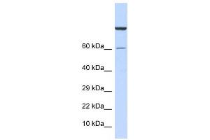 Western Blotting (WB) image for anti-Zinc Finger Protein 251 (ZNF251) antibody (ABIN2458285) (ZNF251 Antikörper)