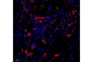 Immunofluorescence of paraffin embedded human kidney using KCTD19 (ABIN7075147) at dilution of 1: 500 (450x lens) (KCTD19 Antikörper)