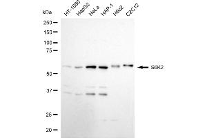 anti-Ribosomal Protein S6 Kinase, 70kDa, Polypeptide 2 (RPS6KB2) antibody
