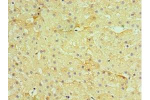 Immunohistochemistry of paraffin-embedded human liver tissue using ABIN7155385 at dilution of 1:100 (H2AFZ Antikörper  (AA 1-128))