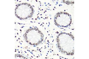 Immunohistochemistry of paraffin-embedded human colon using MonoMethyl-Histone H4-R3 antibody (ABIN1680263, ABIN1680264, ABIN6220110 and ABIN6220114) at dilution of 1:100 (40x lens). (Histone H4 Antikörper  (meArg3))
